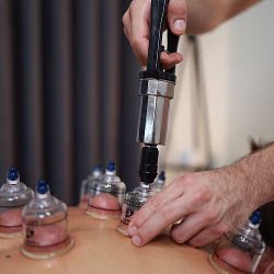 Klijent se opušta tokom cupping terapije, masaže sa čašama koja stimuliše cirkulaciju i oslobađa mišićnu napetost.